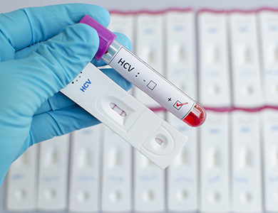 Healthcare worker holding a hepatitis test