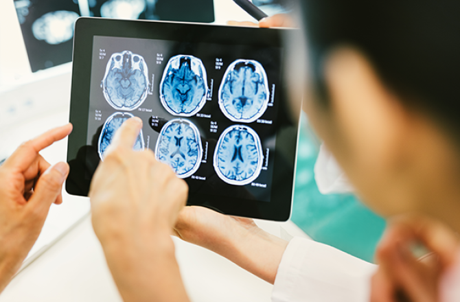 Two people reviewing MRI images of a brain on a tablet.