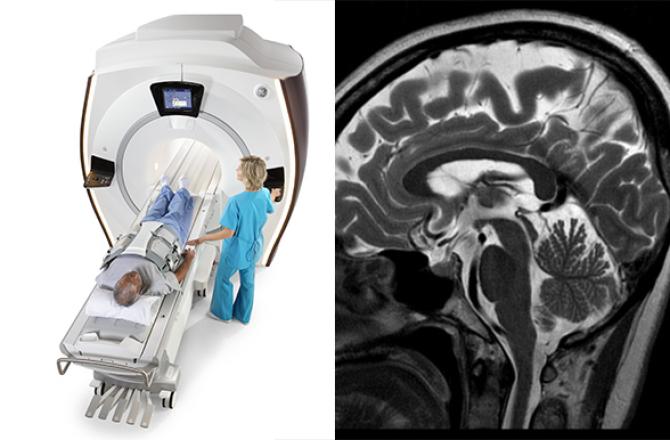 Side-by-side images of a person being scanned by an MRI machine and a brain MRI scan.
